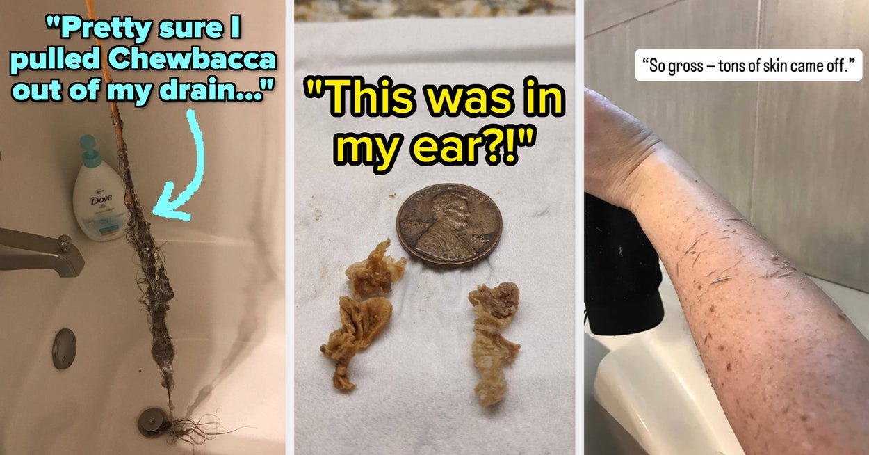 Good Luck Getting Through This Entire List Of 31 Products With Gag-Worthy Before And After Pics