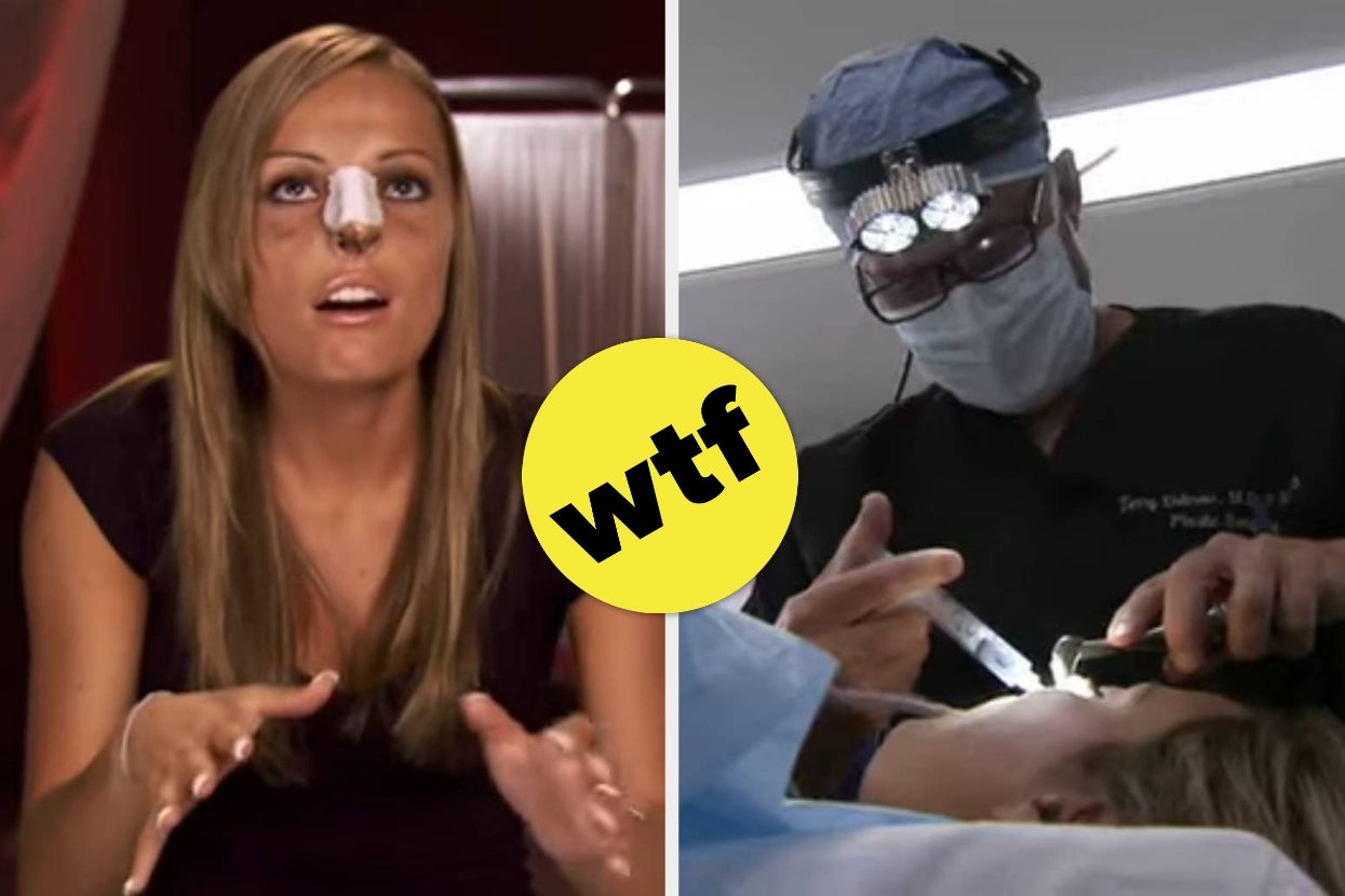 Woman with bandaged nose talking; doctor performing nose job on patient. Yellow circle with "WTF" text in center