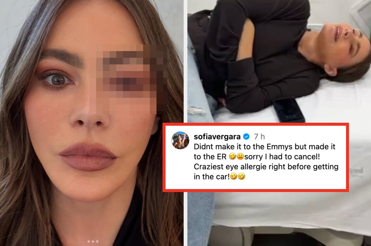 Sofía Vergara Had To Drop Out Of The Emmys At The Last Minute Due To The “Craziest” Medical Emergency — And It Looks Super Painful