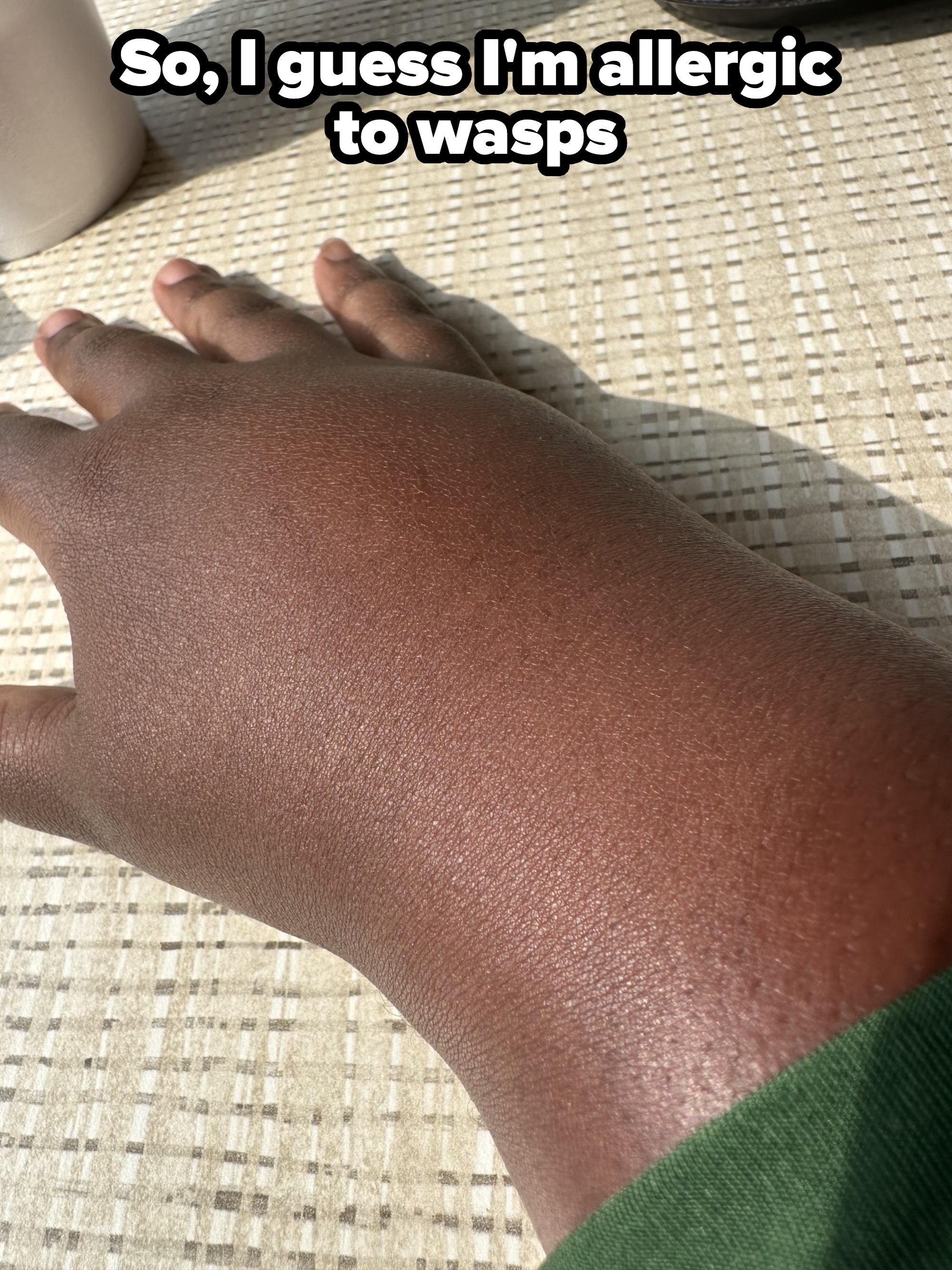 Hand resting on a patterned surface, with sleeve partly visible. Bright lighting creates a soft shadow