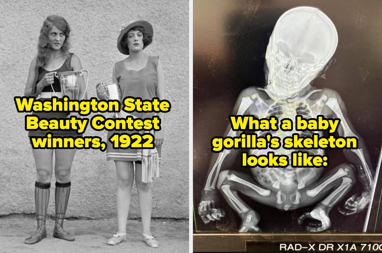 Left: Two women holding trophies, titled "Washington State Beauty Contest winners, 1922." Right: X-ray of a seated baby gorilla's skeleton