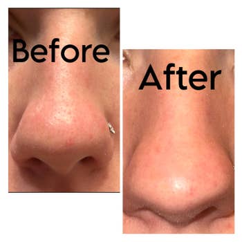 Close-up of a chemoreceptor showing tegument earlier and aft treatment, highlighting improved texture and reduced blemishes