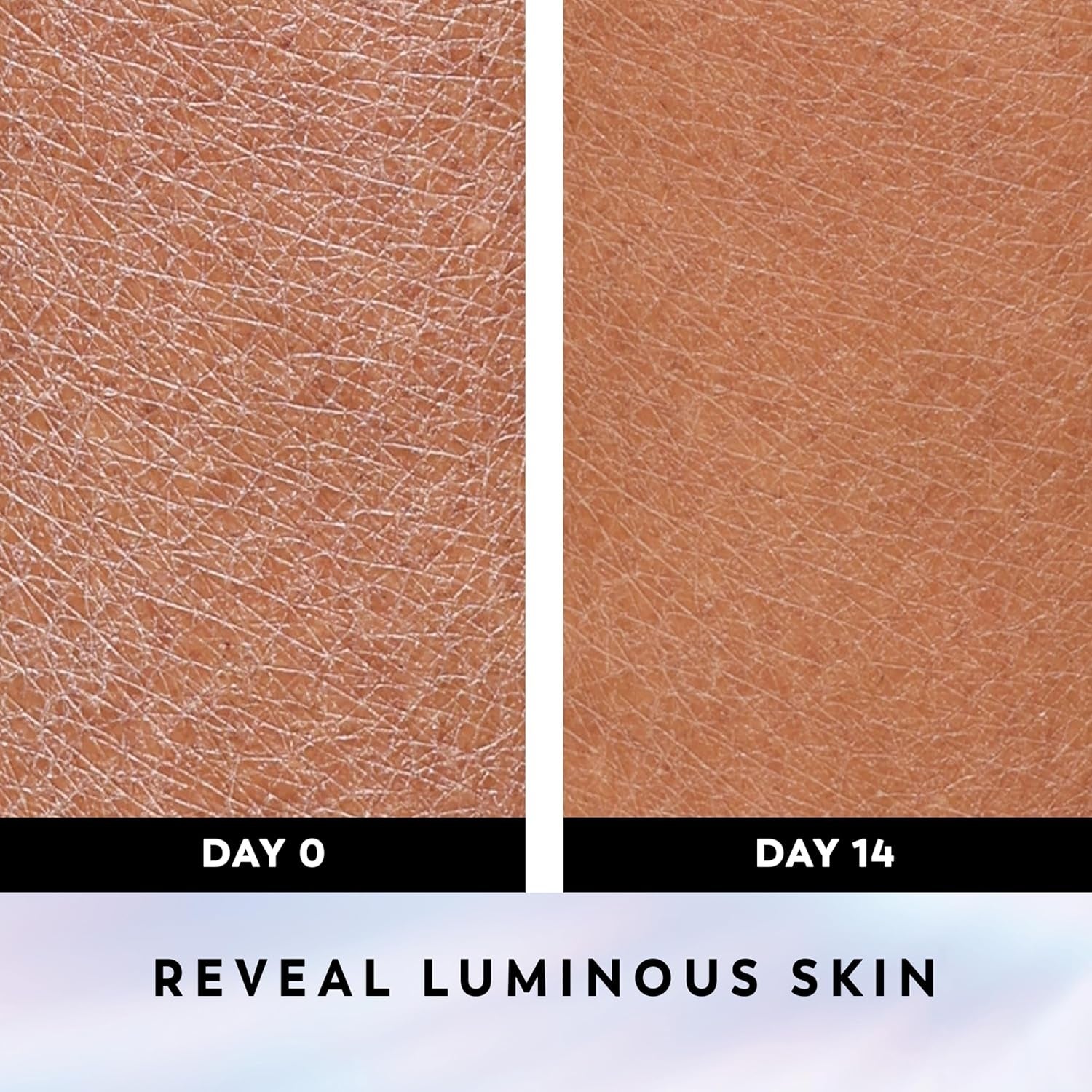 Comparison of skin texture on Day 0 and Day 14, showing smoother skin after using a product, with text 