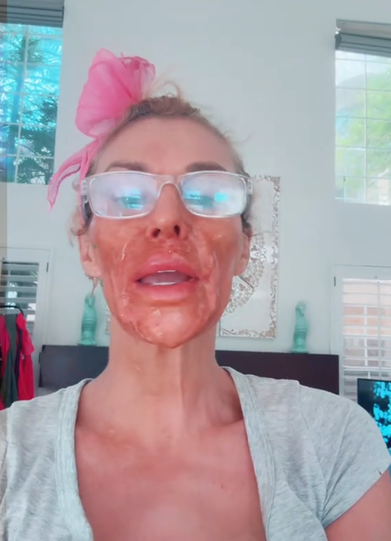 Person with glasses and a pink hair bow wears a brown facial mask. They're in a casual setting, dressed in a light shirt