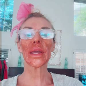 Person with glasses and a pink hair bow wears a brown facial mask. They're in a casual setting, dressed in a light shirt