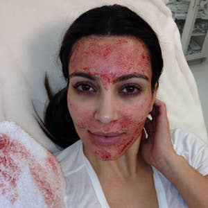 Person with a facial treatment involving red pigmentation applied to the face, lying on a treatment table