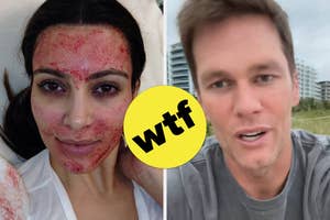 Split image: Left, person with a face treatment. Right, person outdoors, talking to camera. Yellow "WTF" circle overlaps both images