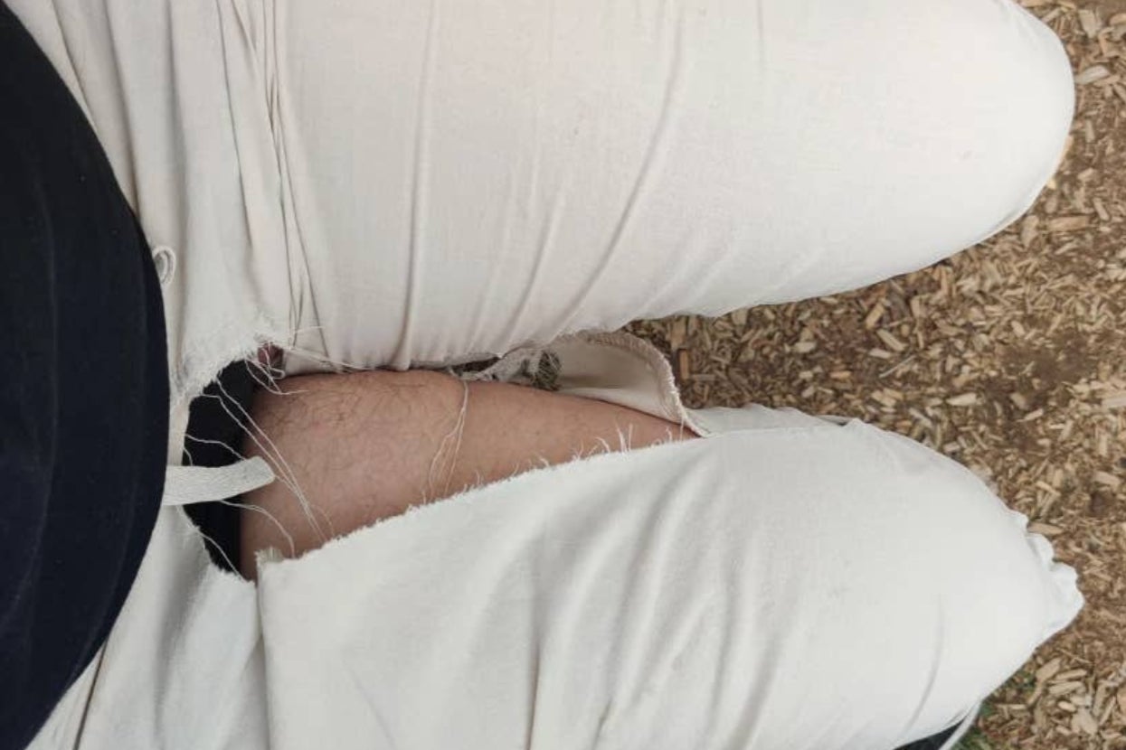 Torn white pants revealing skin underneath. The pants are visibly ripped at the thigh area