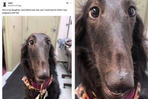Long-nosed dog with a humorous tweet suggesting Tylenol was taken during pregnancy
