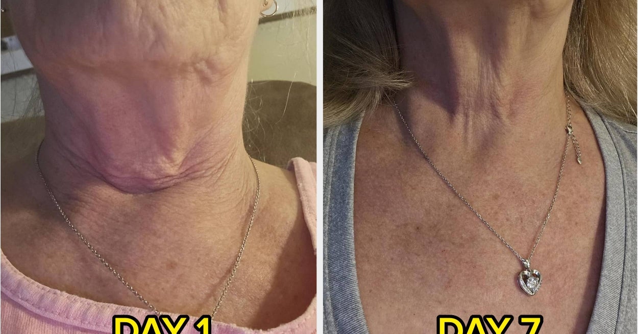32 Before And Afters That Prove These 33 Body Care Products *Actually* Work