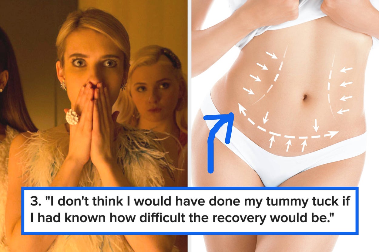 Woman in elegant attire looks surprised; text describes regret about tummy tuck recovery difficulty next to an image of a midriff showing surgery lines