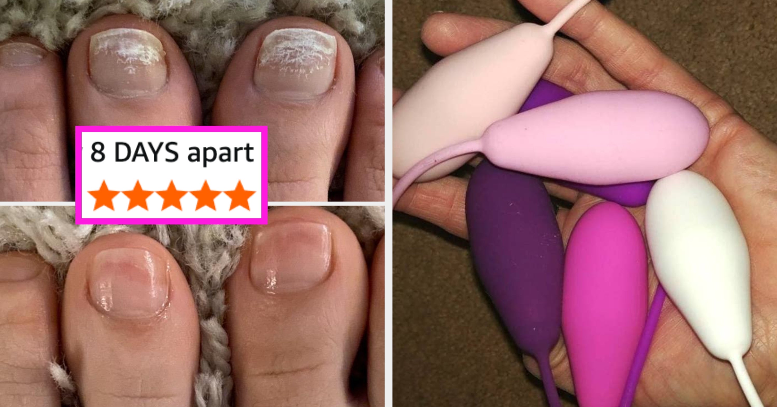 43 Things To Help With Warts, Fungus, Foul Breath, And Other Problems You’d Rather Not Speak Of