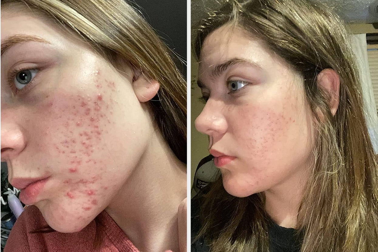27 Beauty Products That Work While You’re Sleeping So You Can Get Results With Very Little Effort