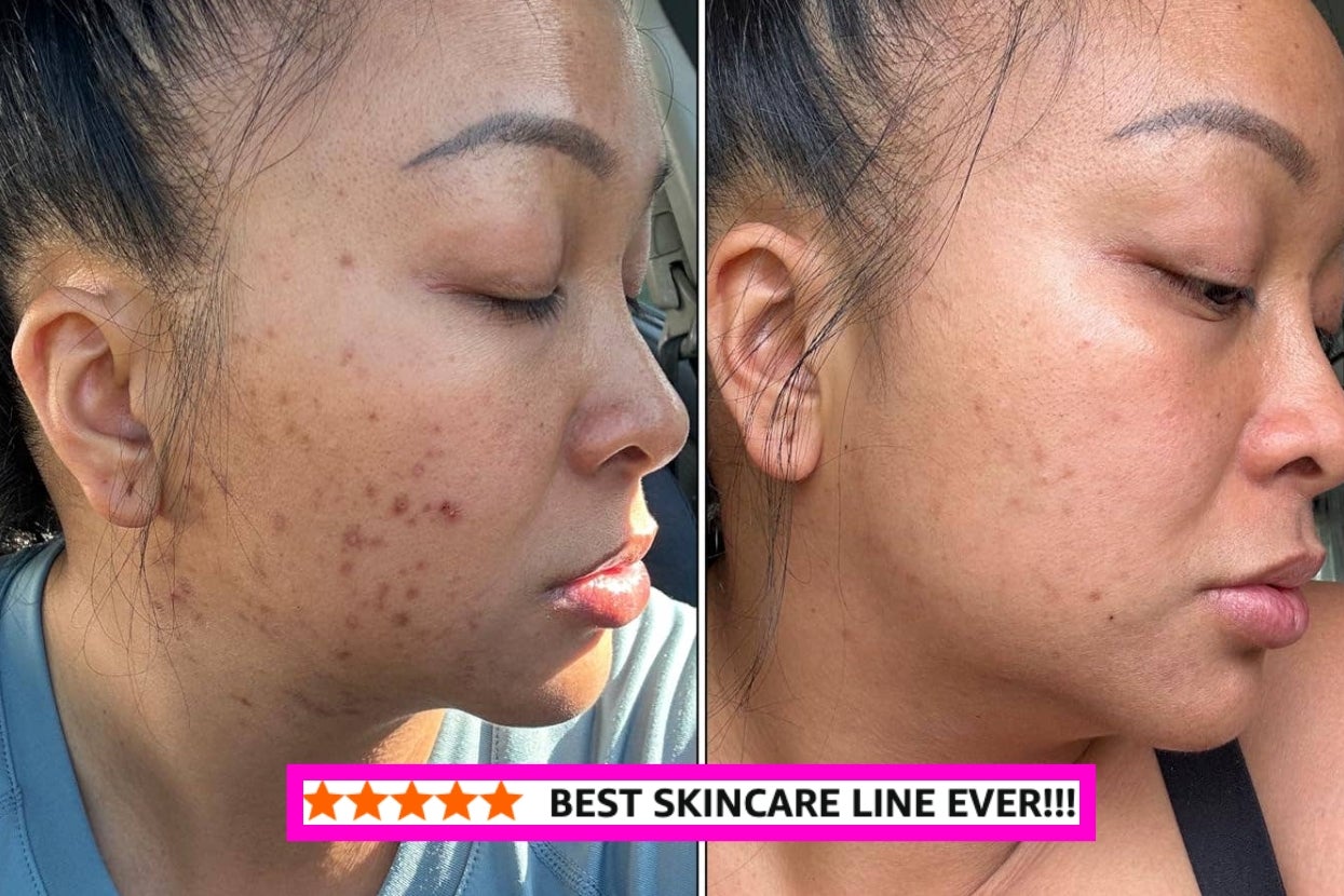 It’s True, These 31 Korean Skincare Products Are Worth Every Cent And Reviewers Agree