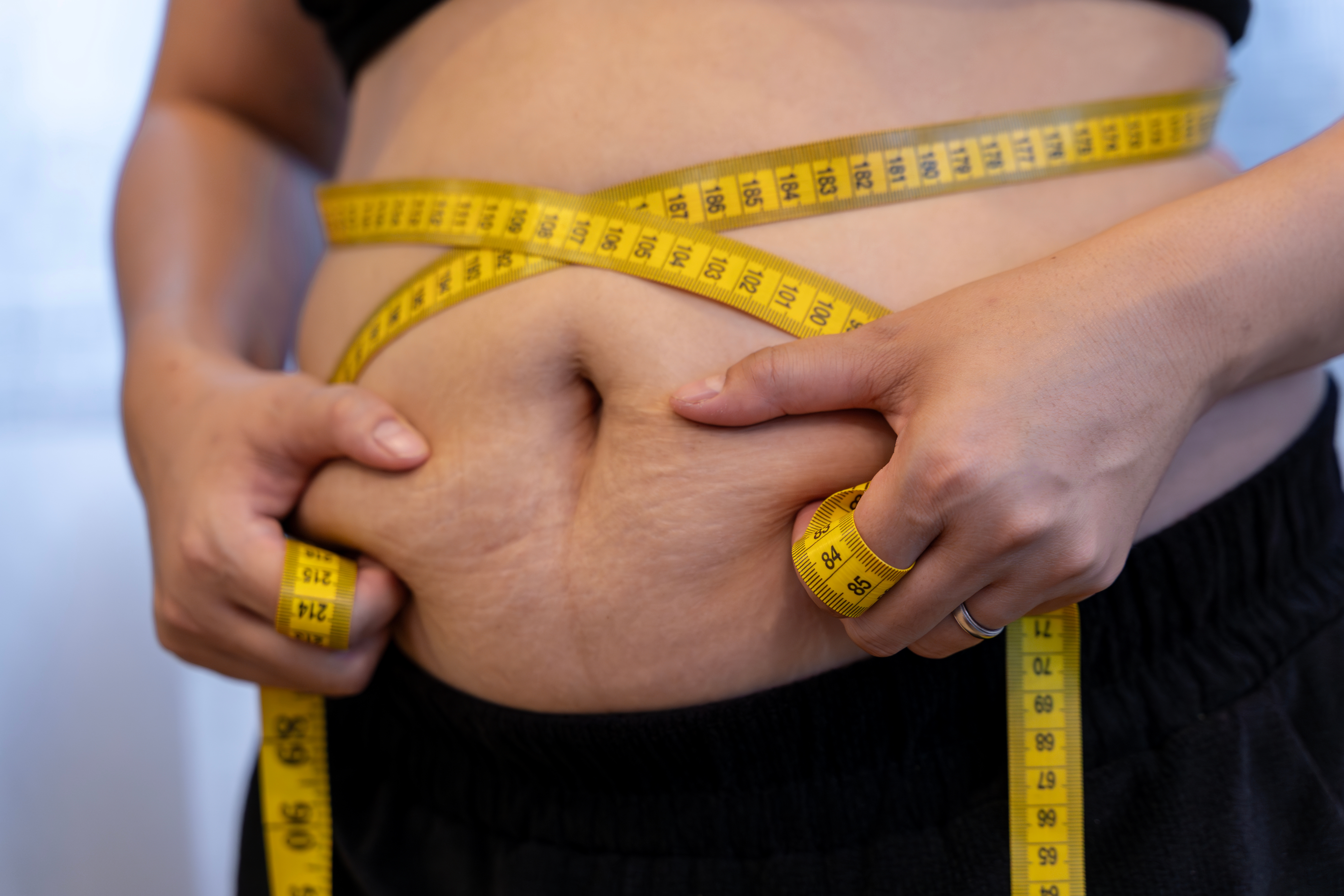 Personen som måler midjen med et målebånd, holder ekstra hud rundt mageområdet