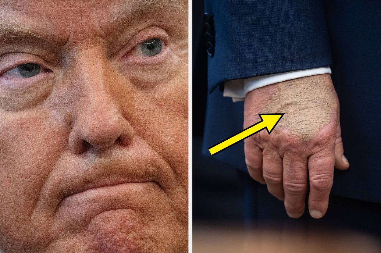 Close-up of Trump's expression, alongside his hand with visible makeup, highlighted by an arrow