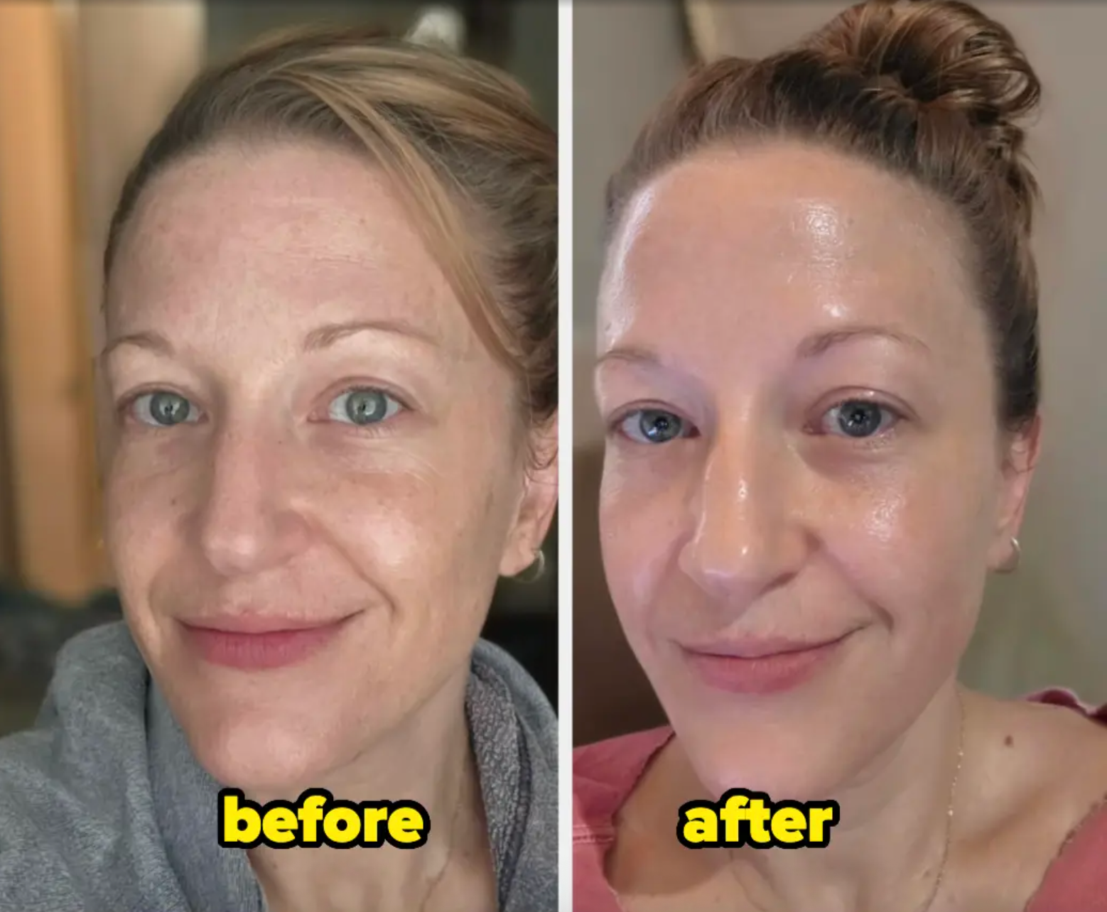 Before and aft  images of a pistillate   highlighting skincare results. The 