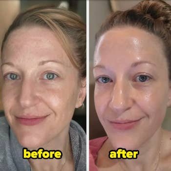Before and aft images of a pistillate highlighting skincare results. The