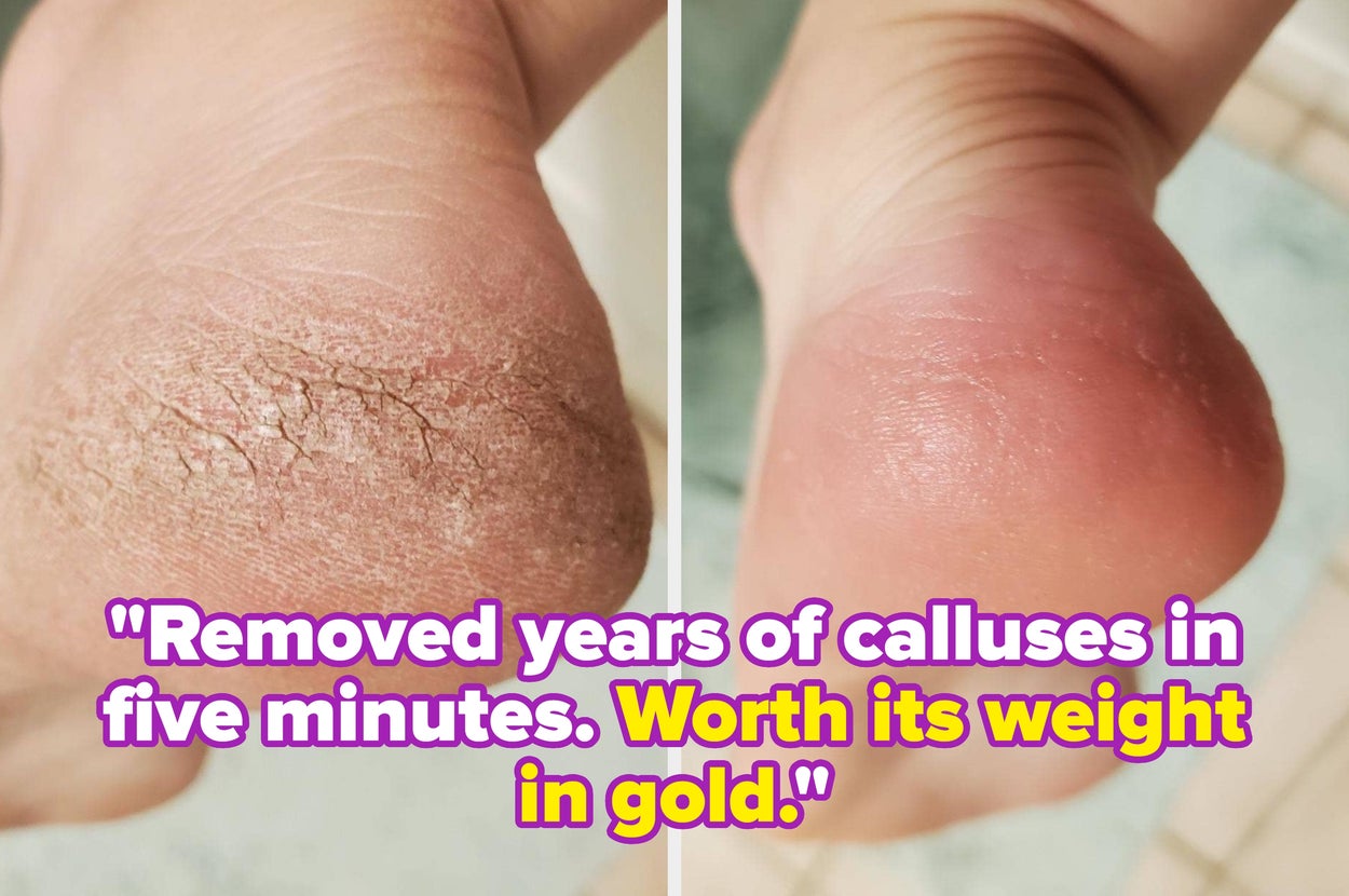 31 Products Reviewers Say Are Worth Way More Than They Actually Cost