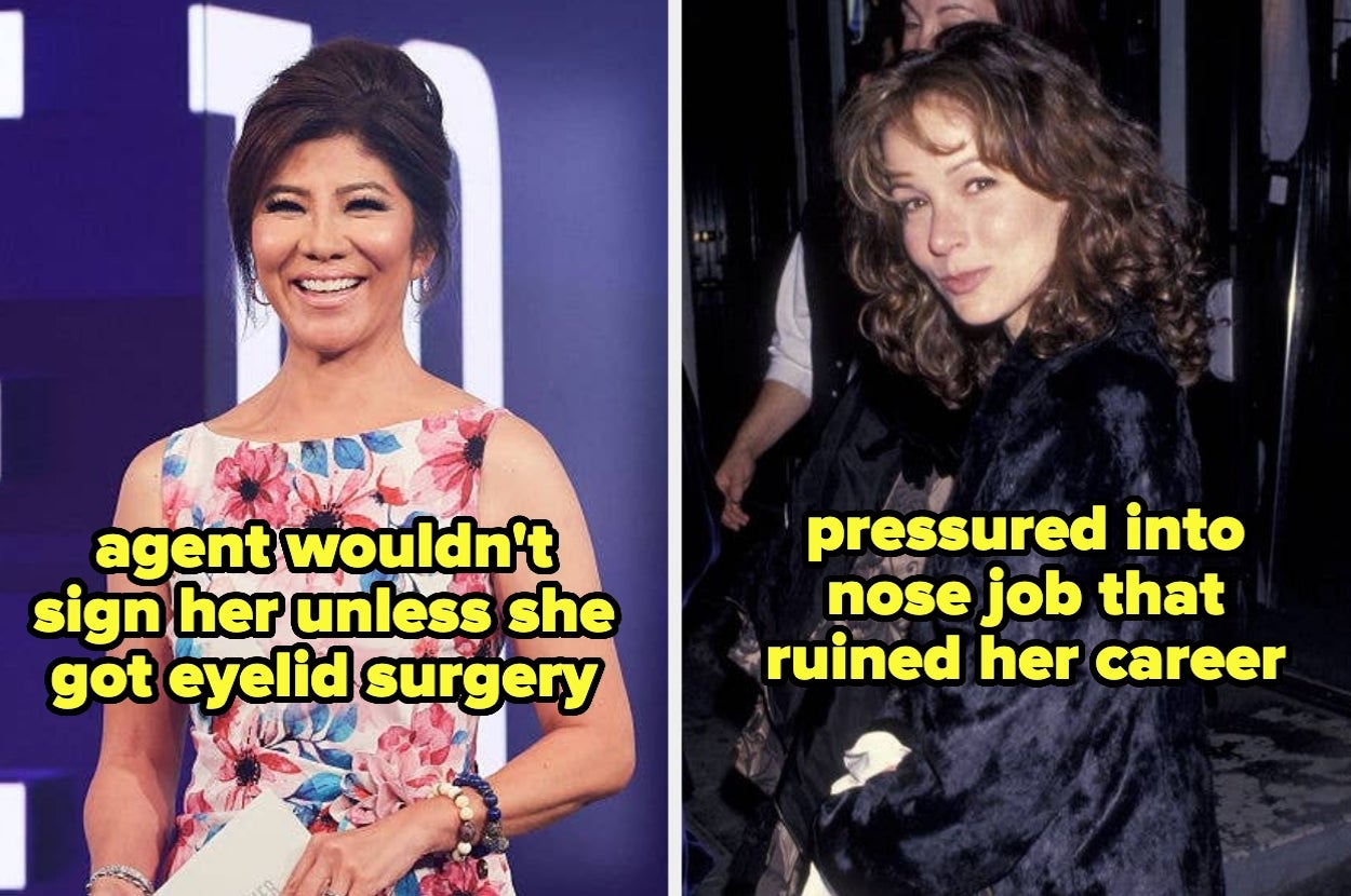 14 Celebs Who Got Literal Cosmetic Surgery To "Make It" In Hollywood