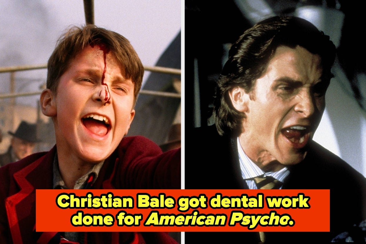 14 Celebs Who Surgically Changed Their Faces And Bodies For Fame
