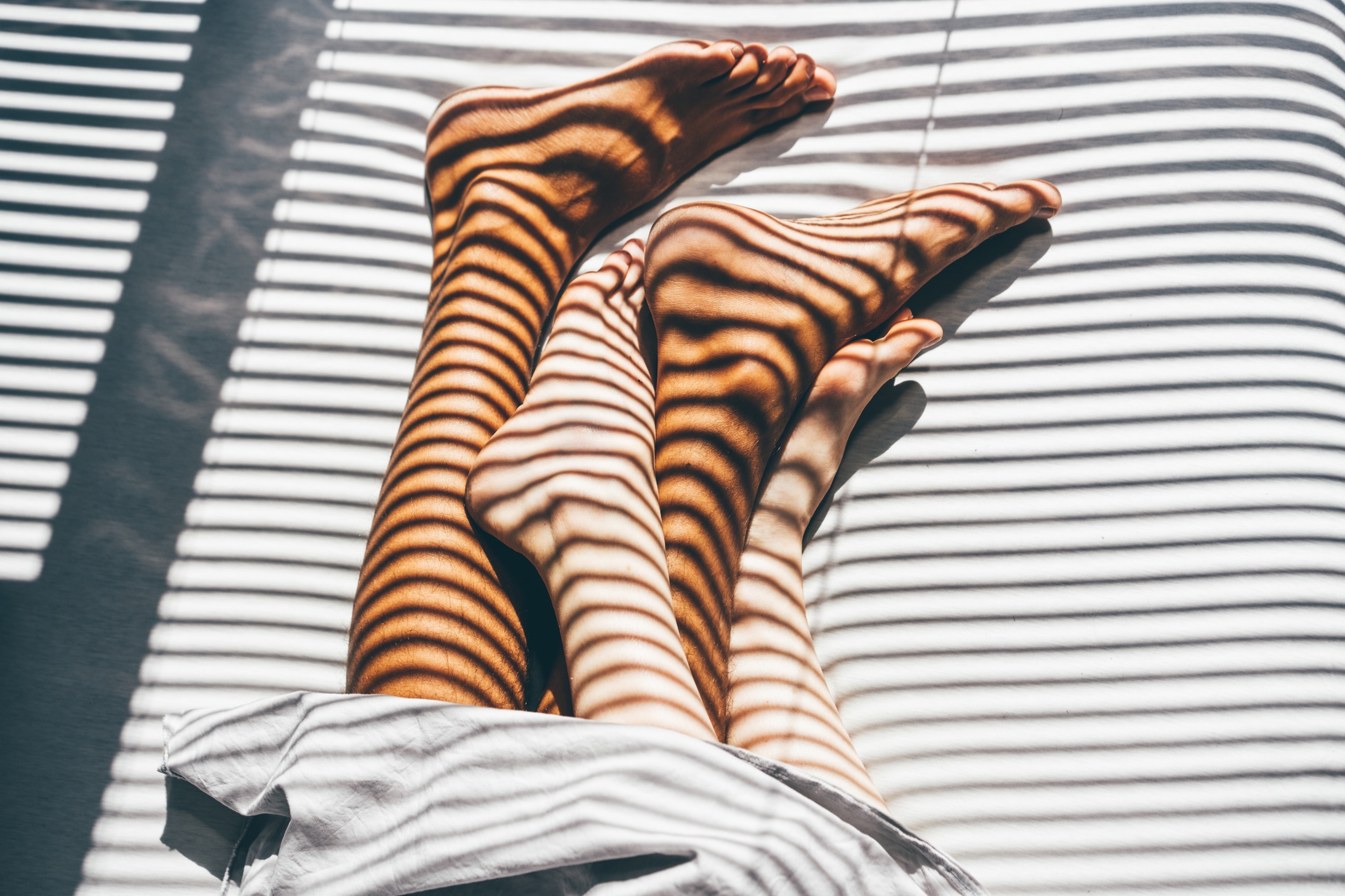 Legs intertwined under sunlight filtered through blinds, creating striped shadows on skin. Sheets partially cover the feet, enhancing the intimate scene