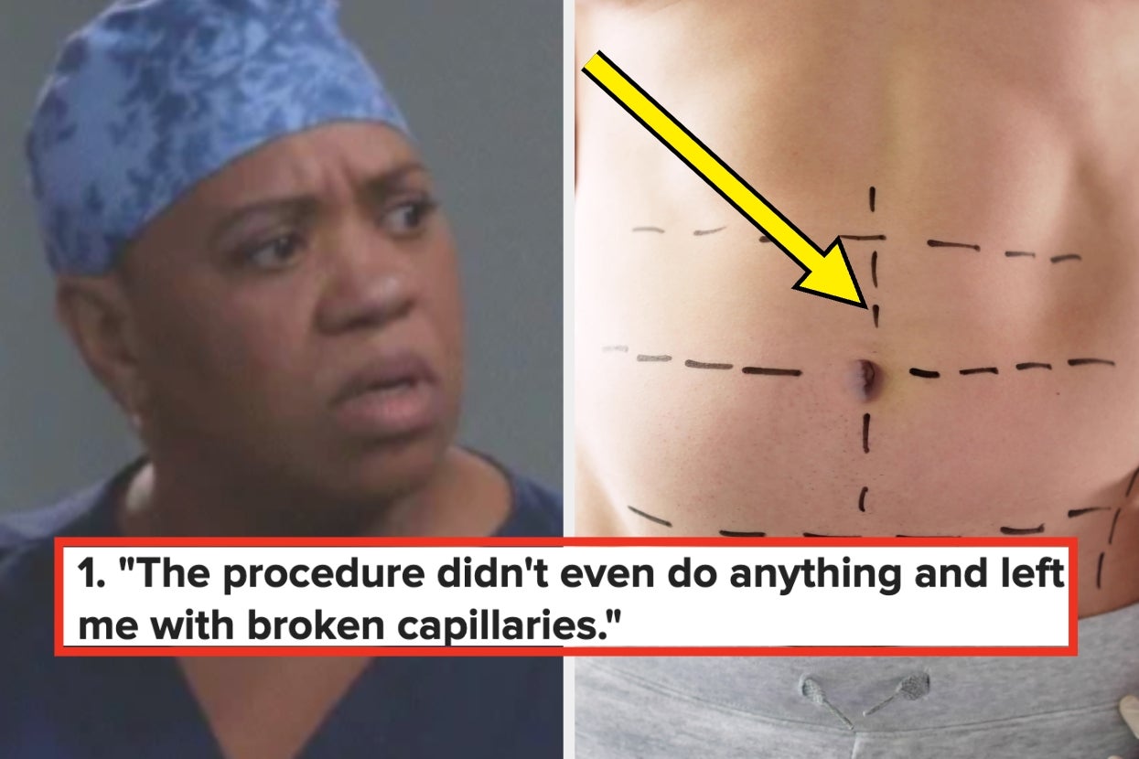 17 Plastic Surgery Procedures People Deeply Regret — And Why They'd Never Do It Again