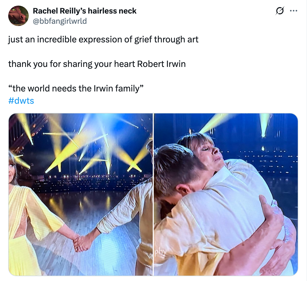 Robert Irwin Dancing With The Stars Mom Tribute: Best Reactions