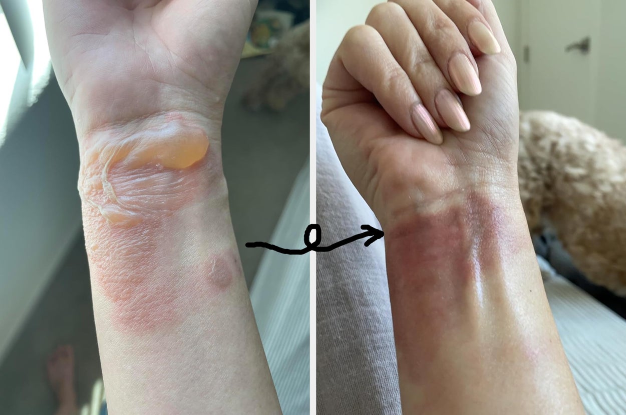 33 Products With Results So Dramatic, Your Eyebrows Will Reach Your Hairline With Shock