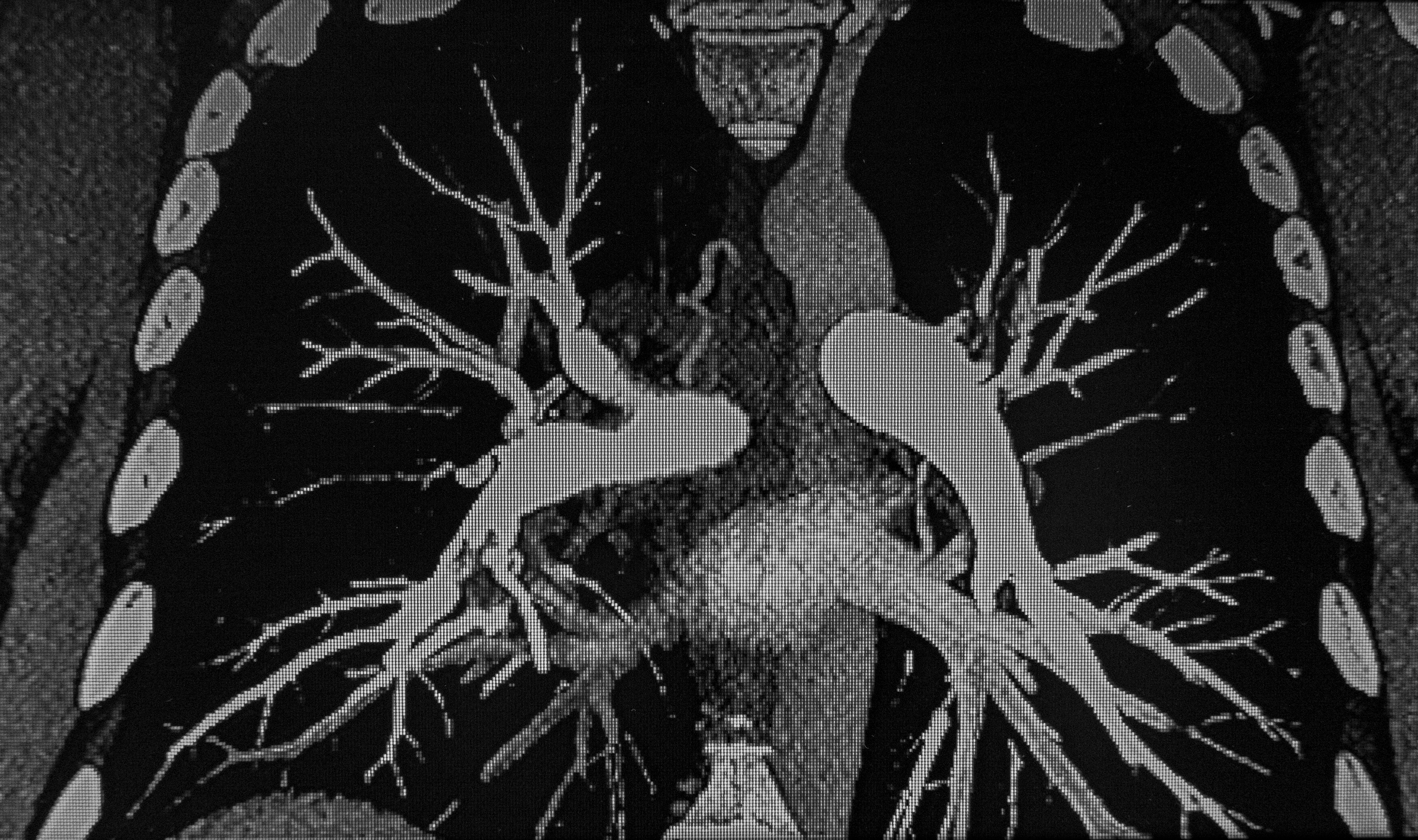 Medisinsk skanning som viser den detaljerte strukturen til lungene og omkringliggende organer