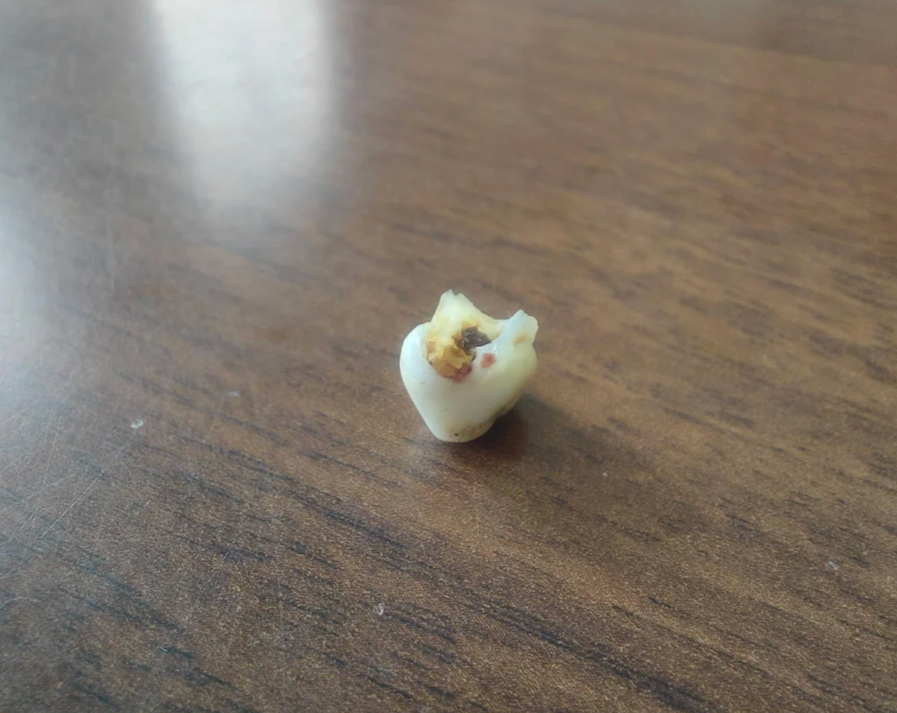 Reddit post titled "My tooth fell out" with an image showing a tooth on a wooden surface