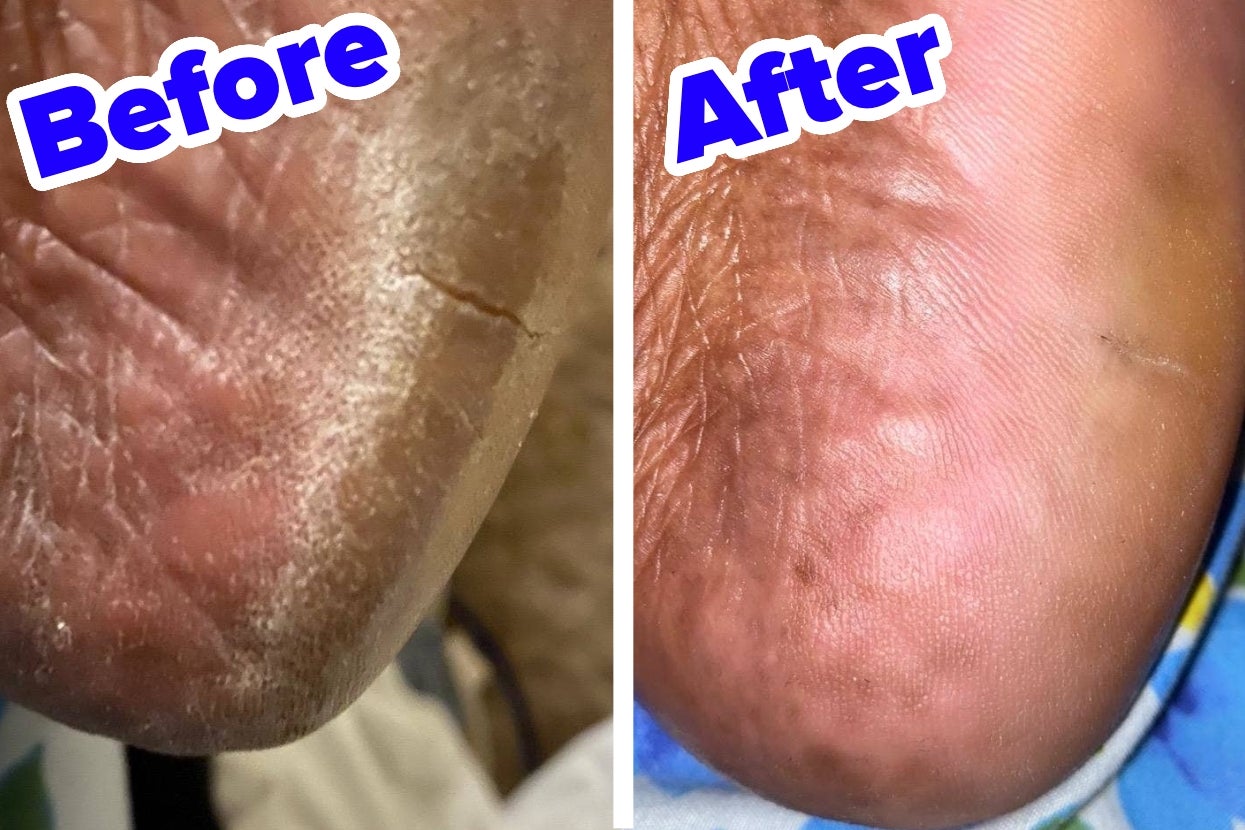 28 Problem-Solving Products That’ll Handle Personal Care Issues Like NBD