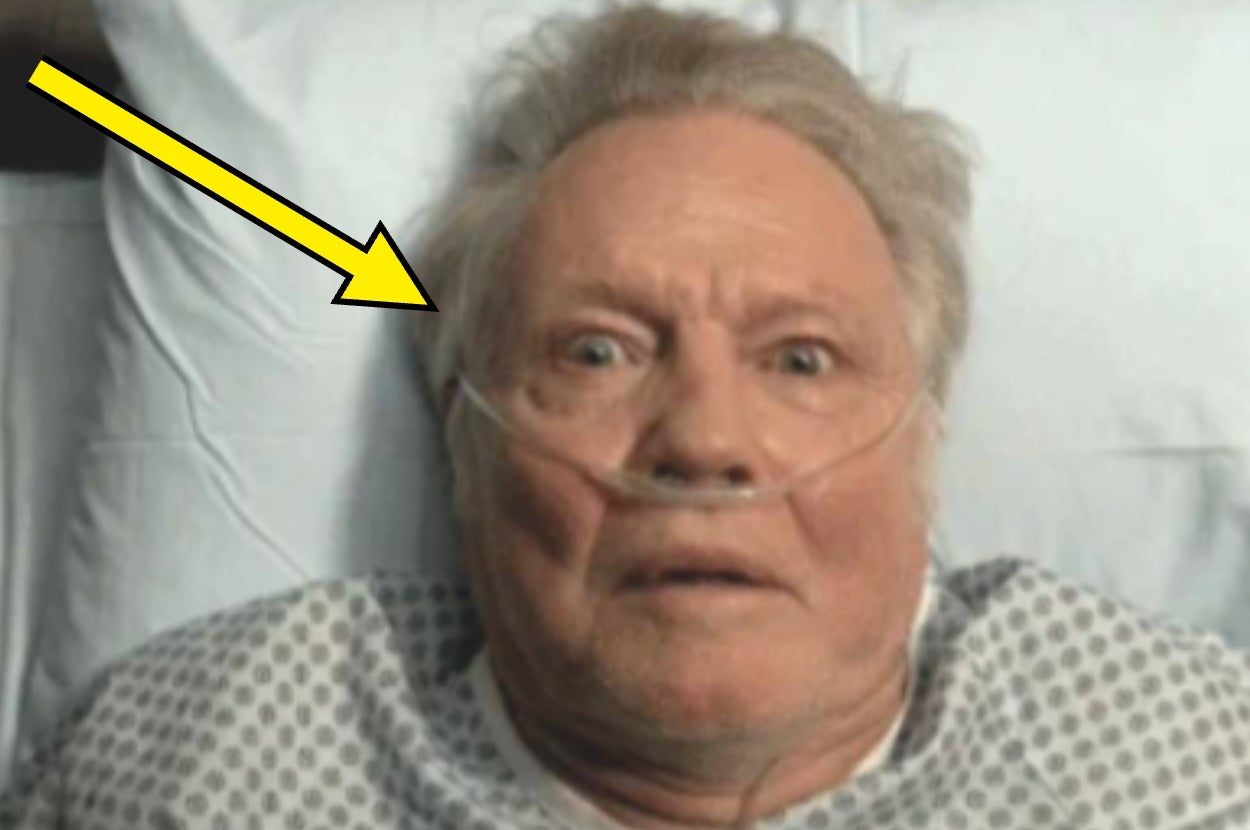 Person in a hospital bed wearing an oxygen tube, looking up. Yellow arrow pointing at face