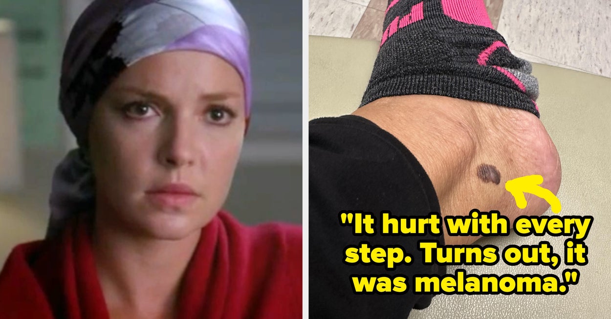 17 Cancer Patients Are Sharing The Concerning Symptoms That Made Them Go To The Doctor ASAP