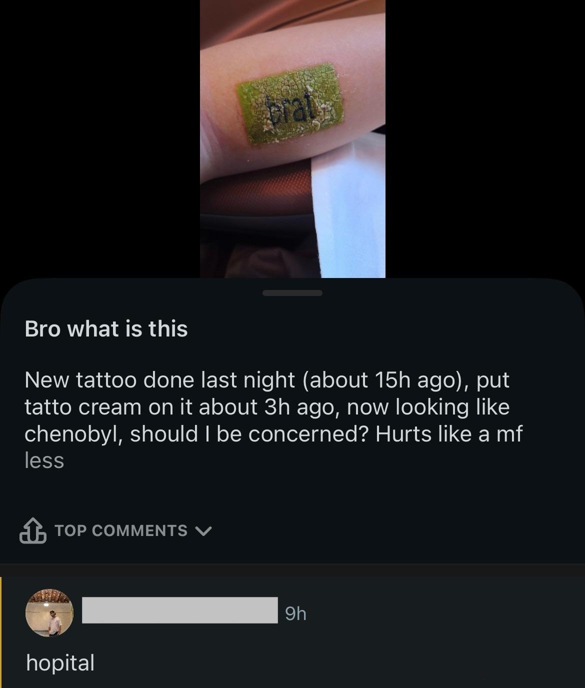 A person asks about a new tattoo&#x27;s appearance after applying cream. They express concern about the look and mention it hurts