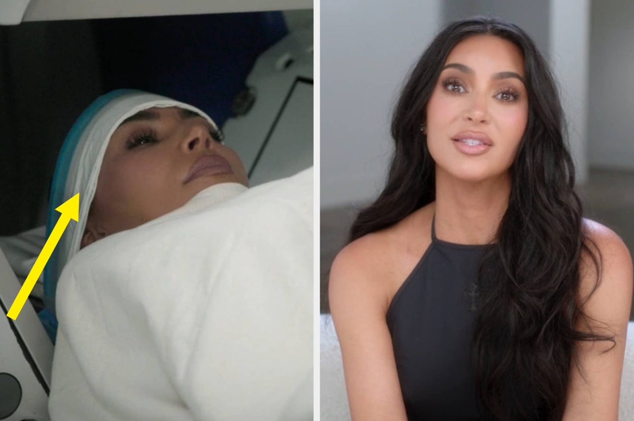 Kim Kardashian Shares Shocking Brain Aneurysm Diagnosis, And It's Beyond Scary