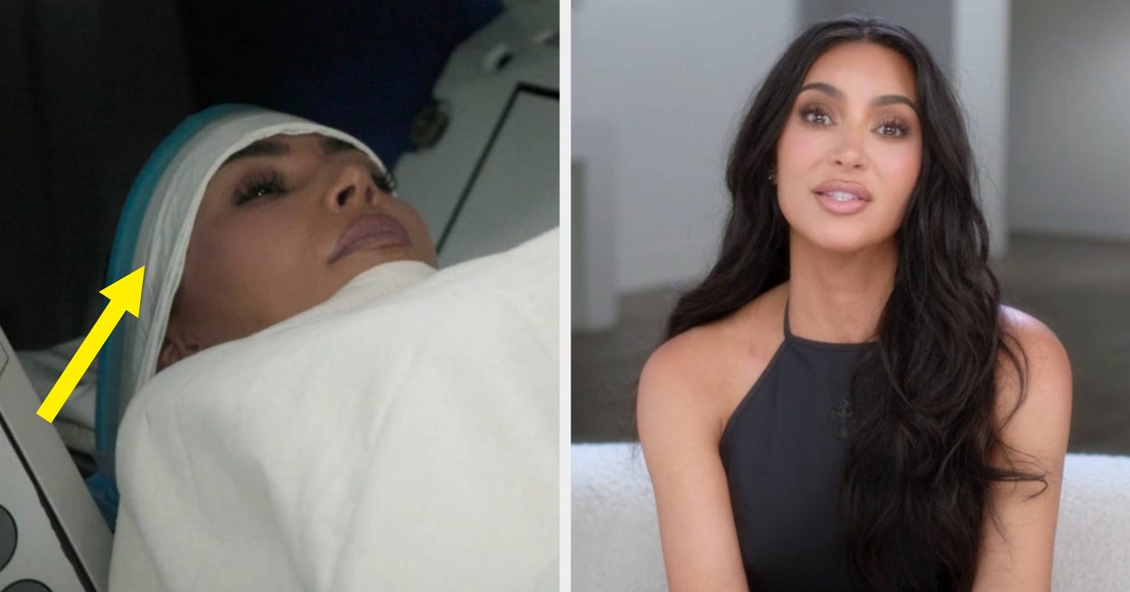 Kim Kardashian Shares Shocking Brain Aneurysm Diagnosis, And It's Beyond Scary
