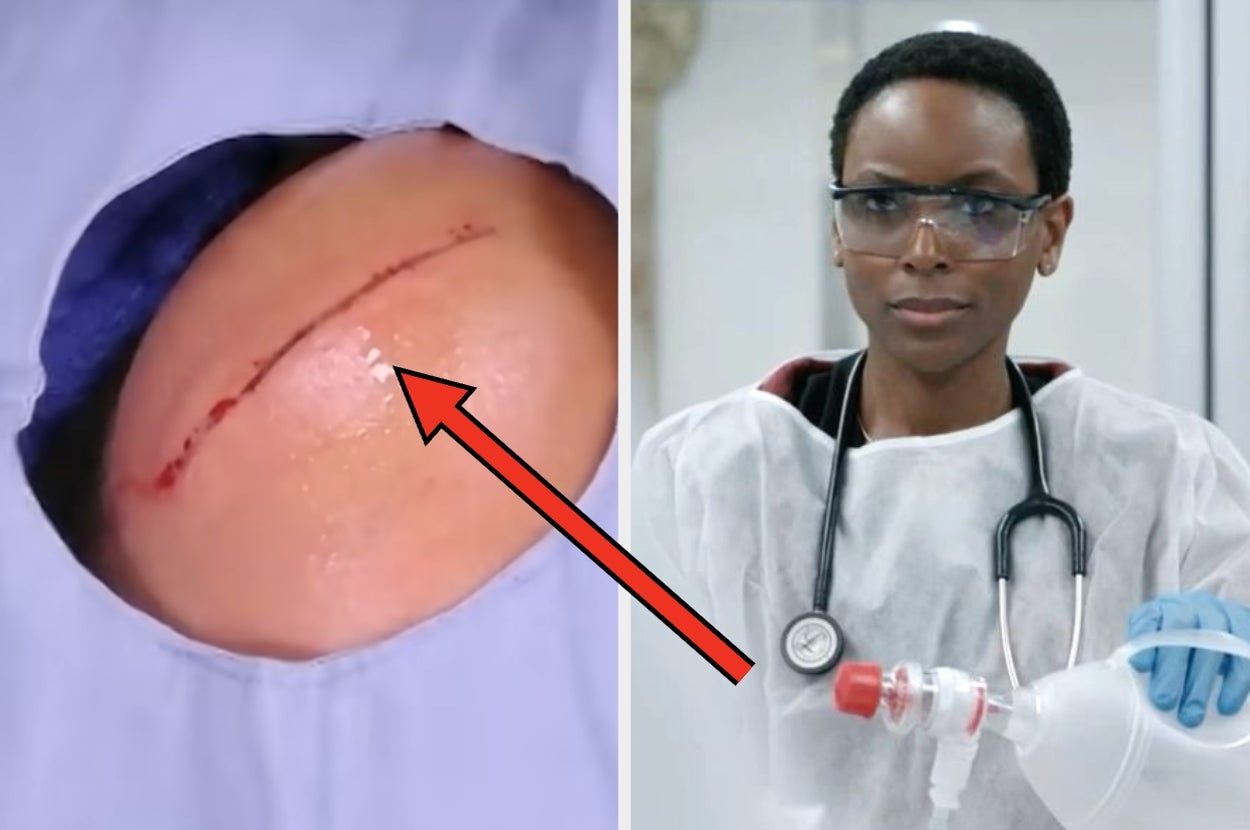 A smiling doctor in scrubs and glasses holds medical equipment next to a close-up of a stitched surgical incision on skin