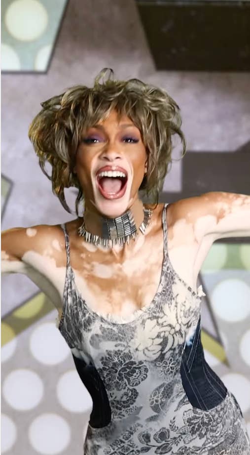 Winnie Harlow Reacts To Whitney Houston Costume Backlash(02)