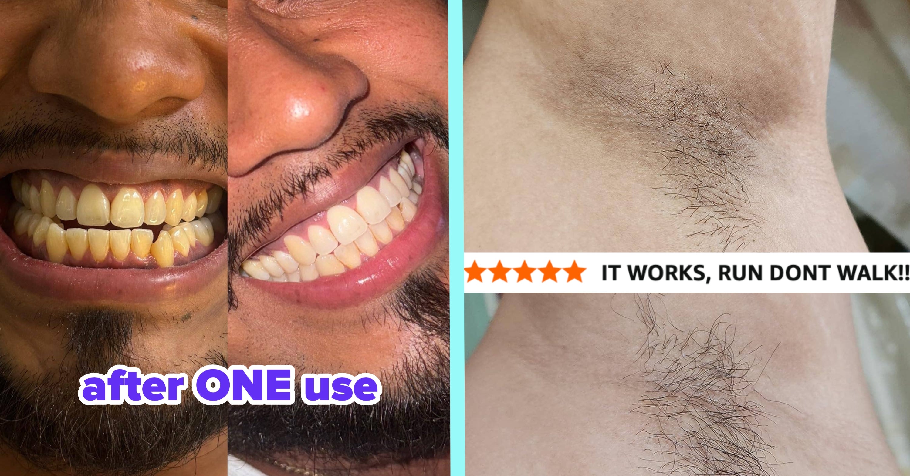 Reviewers Say These 33 Personal Care Products *Actually* Worked, So It's About Time You Gave 'Em A Whirl