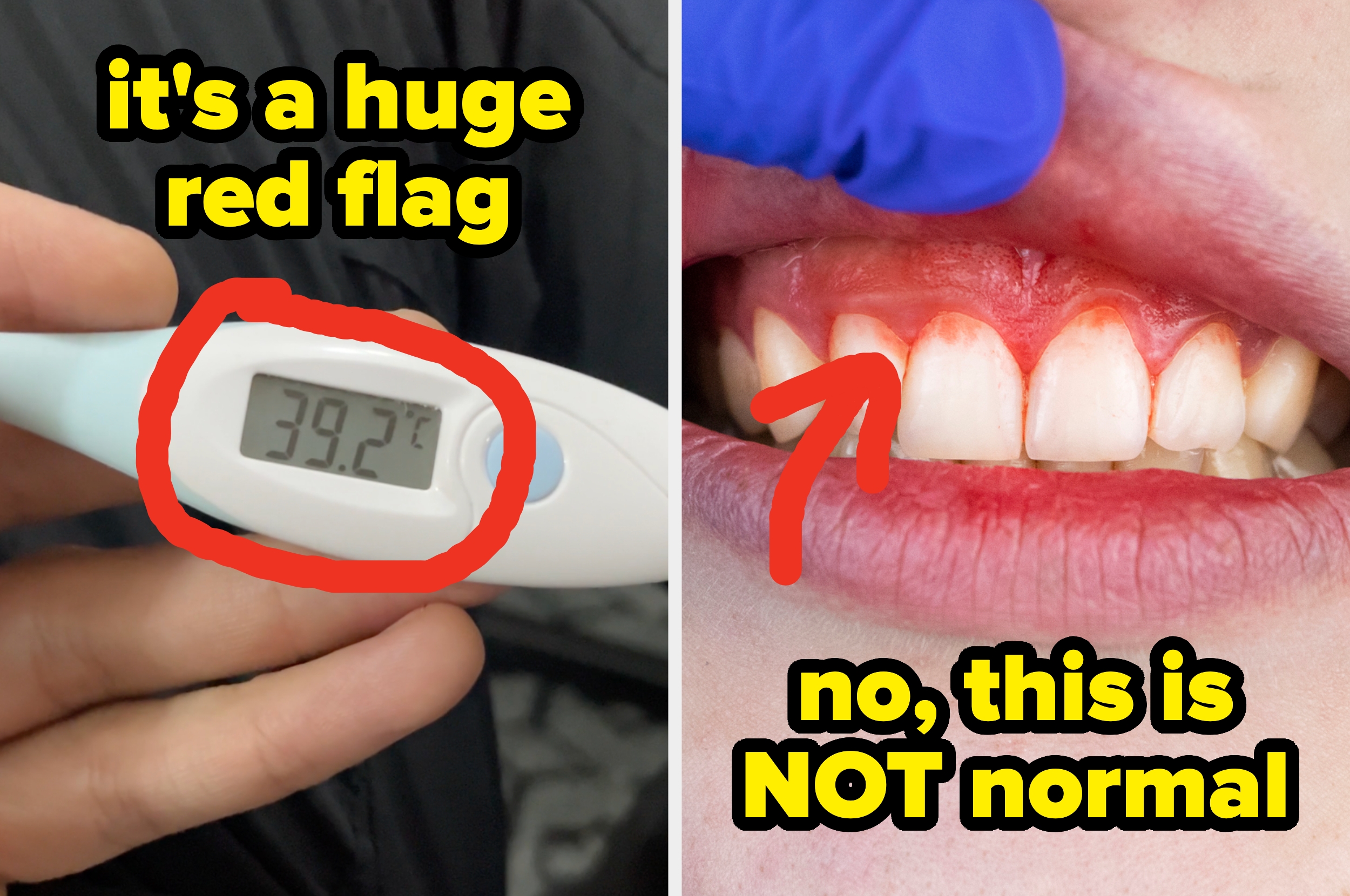 Image shows a thermometer reading 39.2°C with text "it's a huge red flag," and inflamed gums with text "no, this is NOT normal"