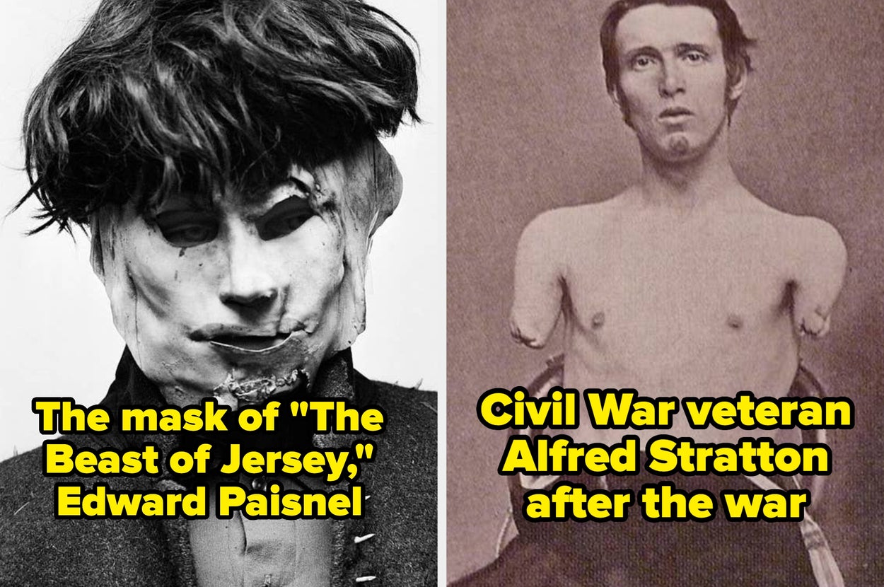 Side-by-side: Creepy mask from "The Beast of Jersey"; amputee Civil War veteran Alfred Stratton post-war