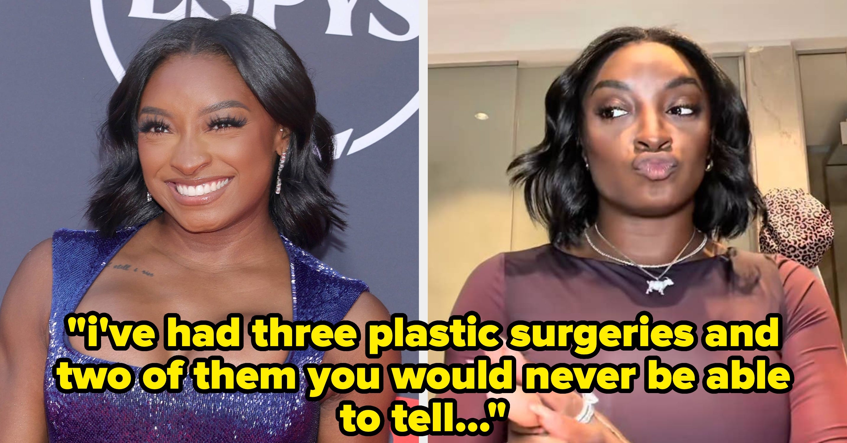 “Two Of Them You Would Never Be Able To Tell”: Simone Biles Detailed Exactly What Cosmetic Procedures She’s Had Done, And Wow