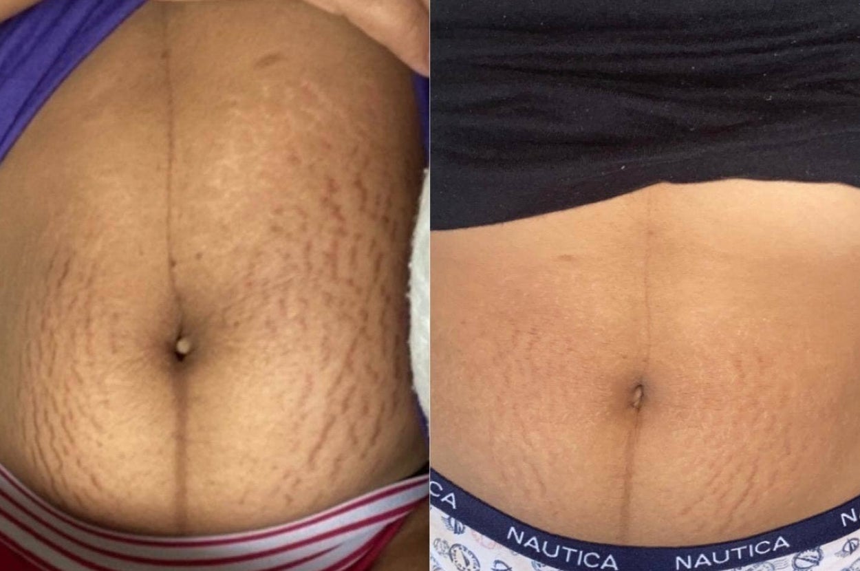 33 Products To Help Solve The Grooming Issues You Wish Would Disappear