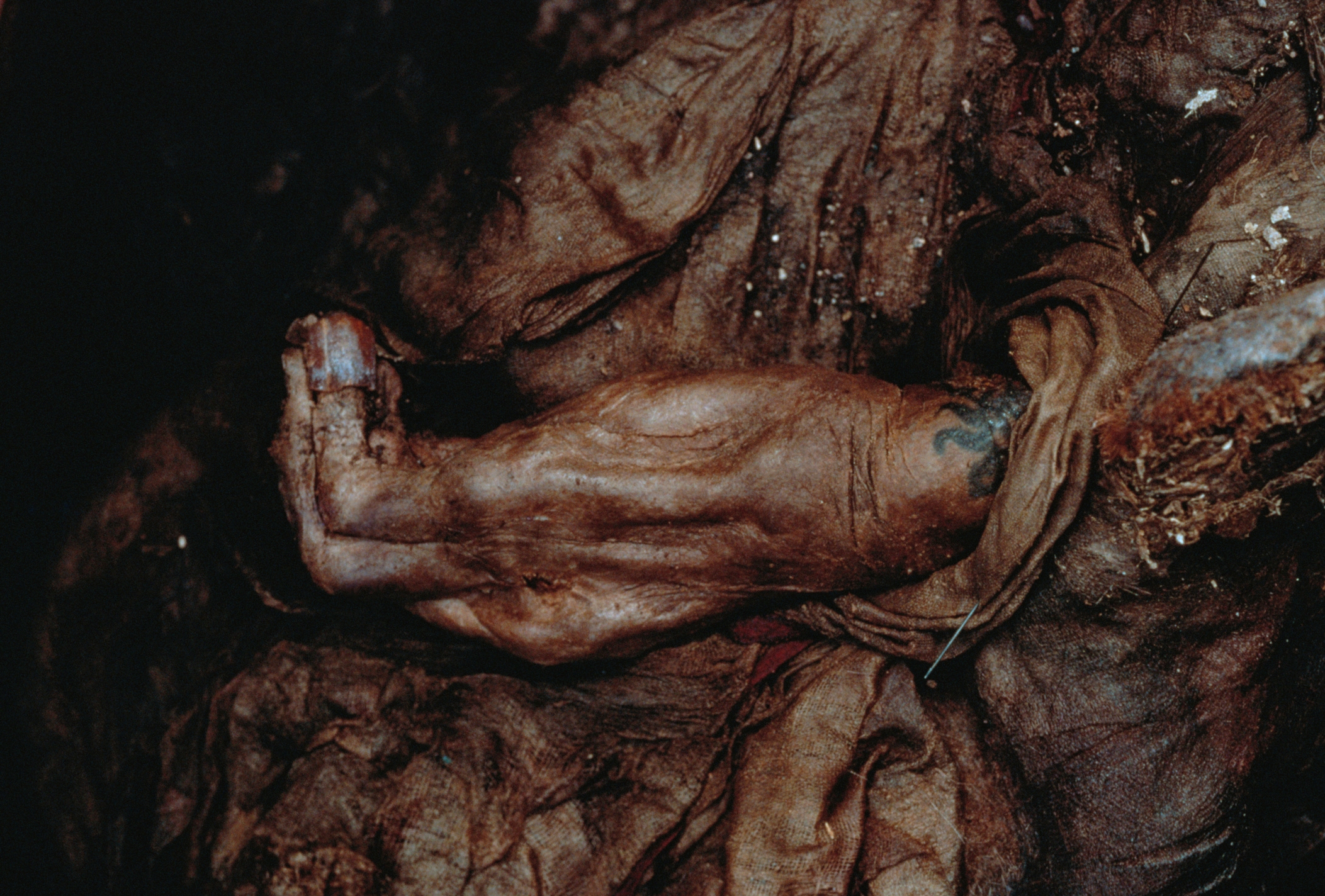 Mummified limb wrapped successful cloth, displaying a tattoo, suggesting past preservation