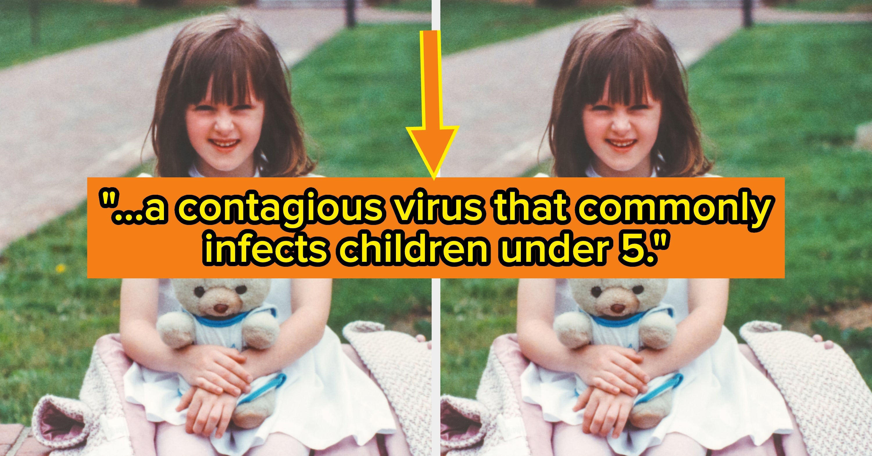 Doctors Warn About Highly Infectious Virus Outbreak