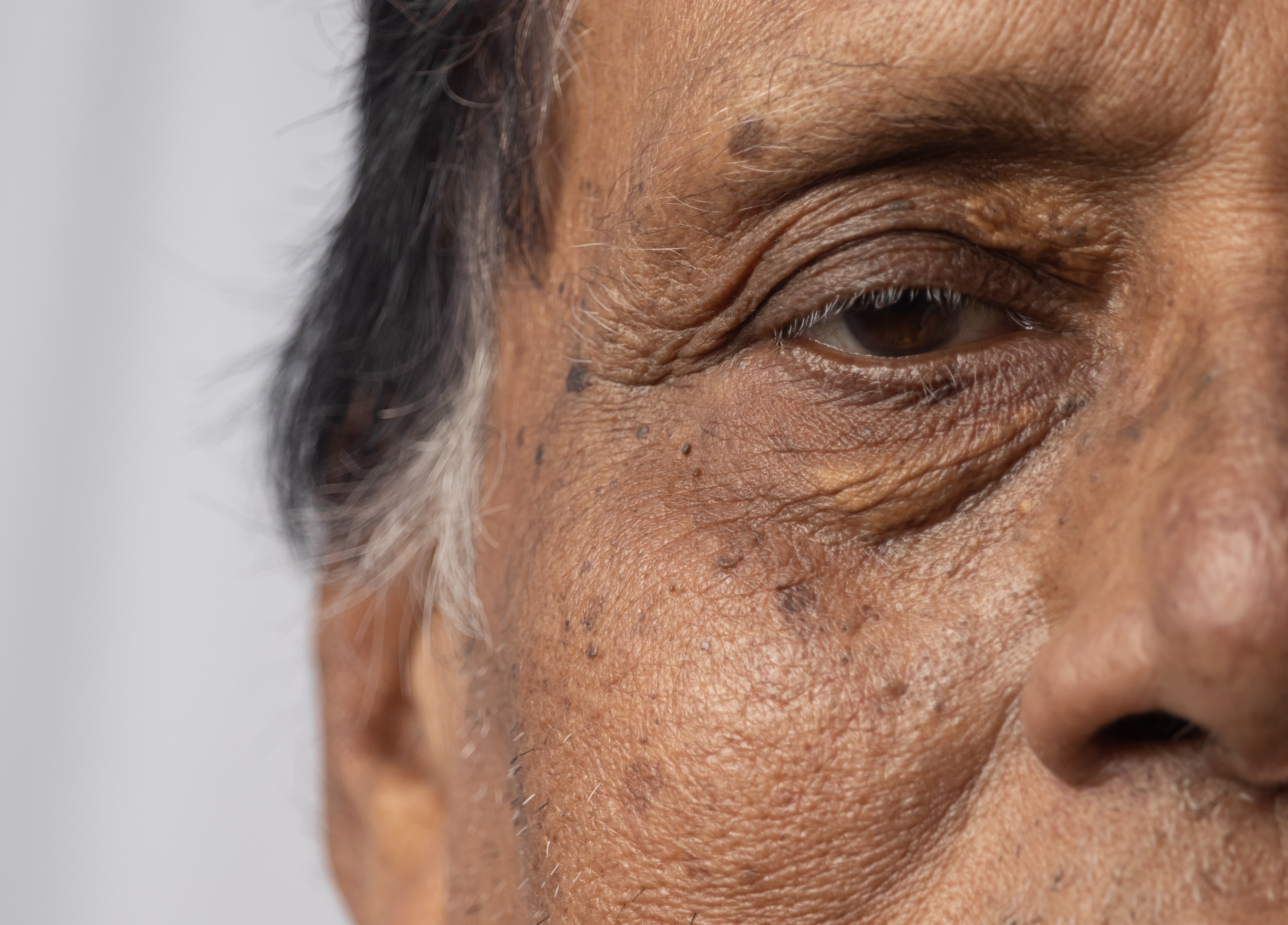 Nærbilde av en eldre persons ansikt, viser rynker og tekstur, fremhever et liv med erfaring og visdom