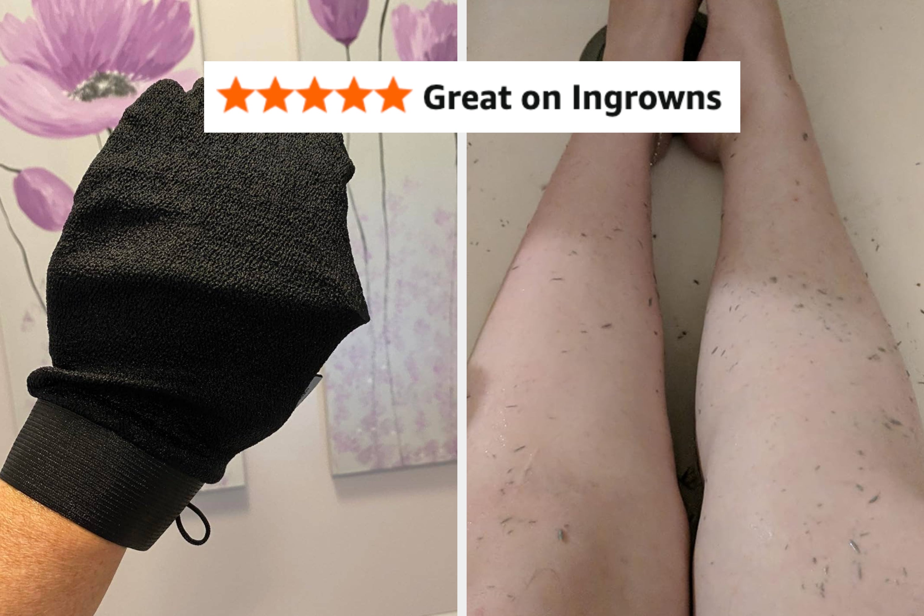 37 Products To Help Solve Those Persistent Body Problems That Make You Want To Crawl Under A Rock