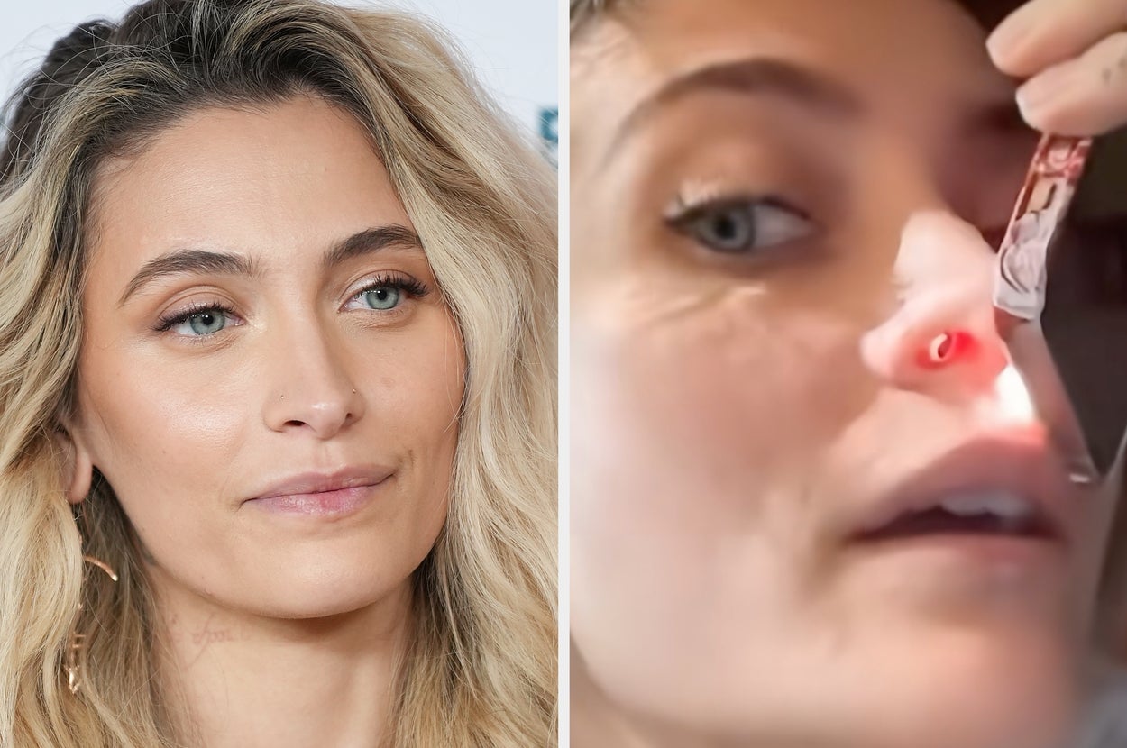 Paris Jackson Revealed The Shocking Condition She Has From Prior Drug Use