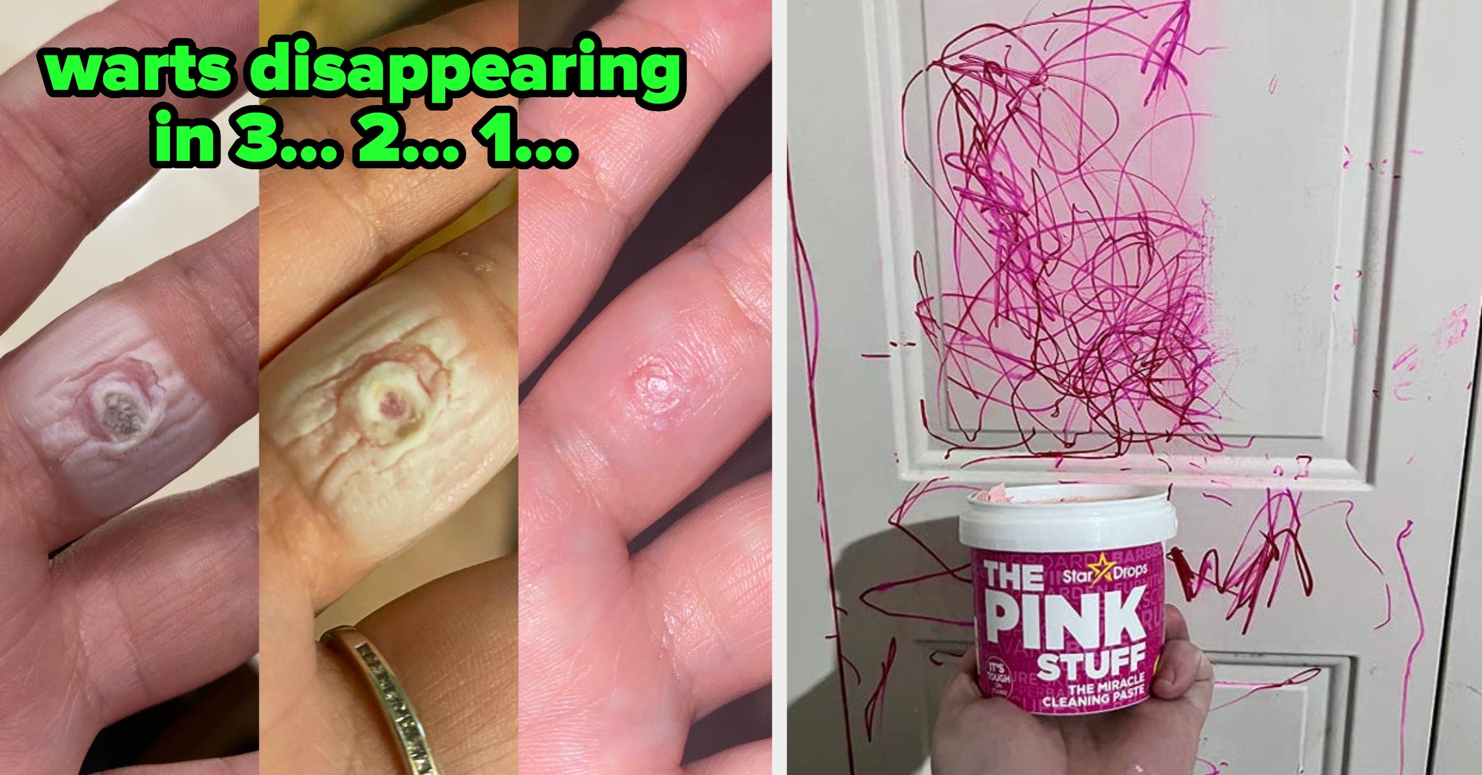 You’re Probably Gonna Want To Sit Down For This: 32 Products With Shocking Before And After Pics